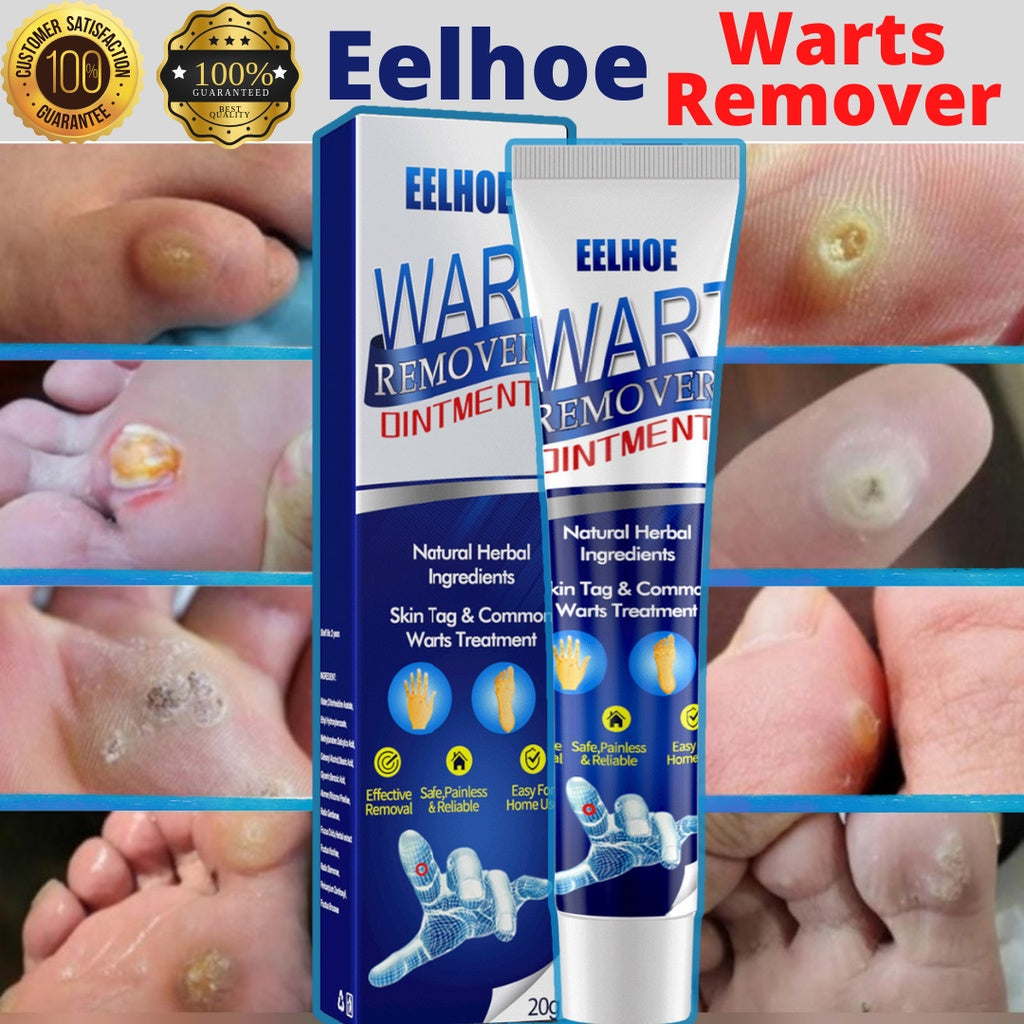 Warts Remover Ointment ™