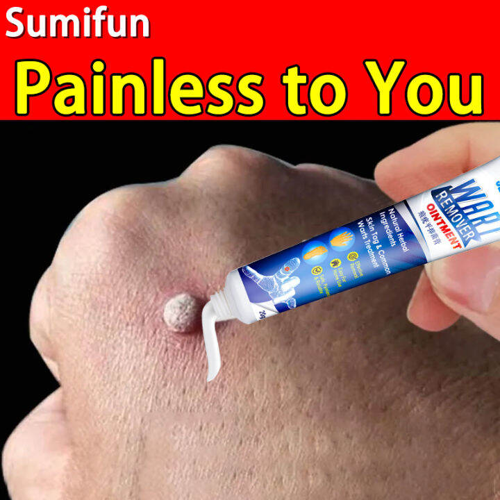 Warts Remover Ointment ™